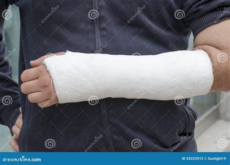 man with broken arm